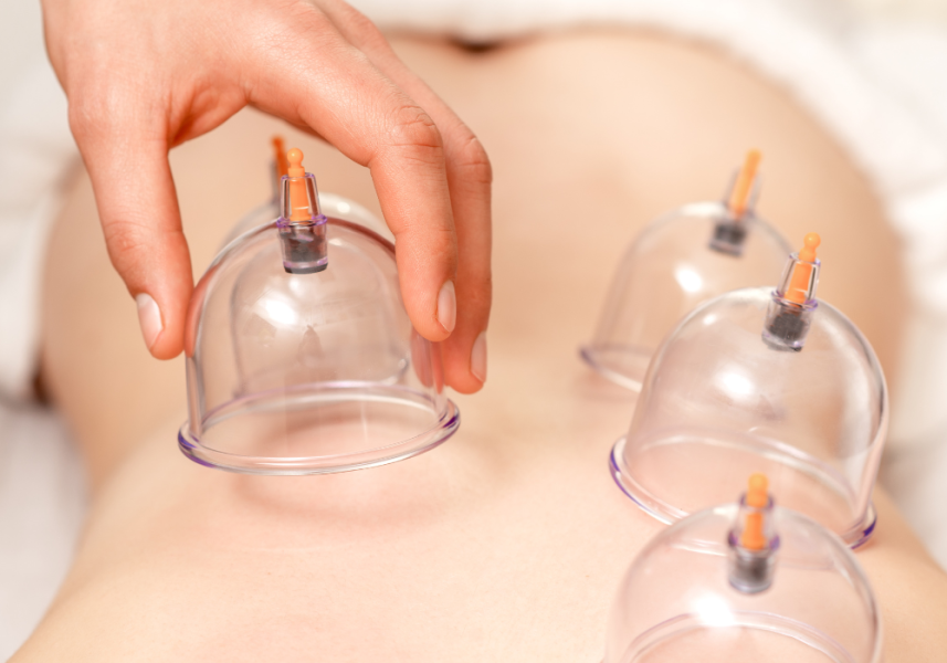 Fermata Integrated - Person Placing Cups On Woman's Back - Cupping Therapy Uses And Benefits Blog